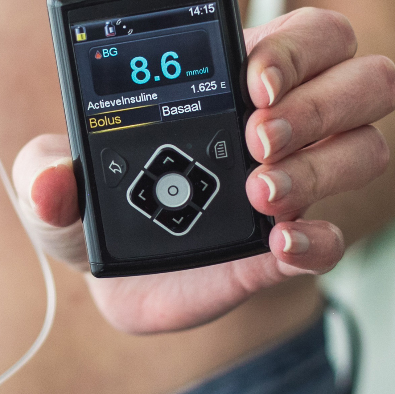 woman-holding-an-insulin-pump